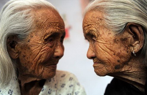 Anak Kembar Tertua Di Dunia [ www.BlogApaAja.com ]